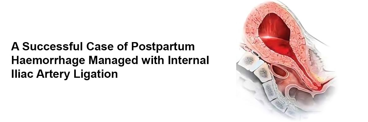 A Successful Case of Postpartum Haemorrhage Managed with Internal Iliac Artery Ligation