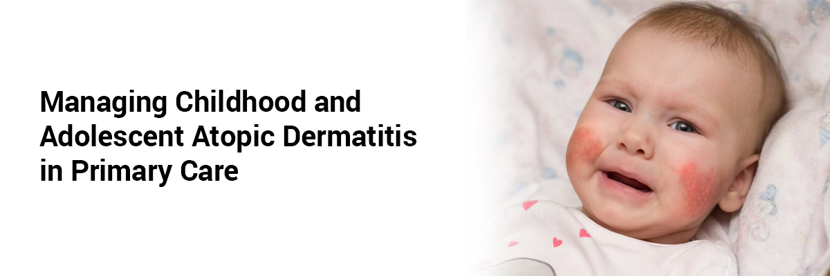 Managing Childhood and Adolescent Atopic Dermatitis in Primary Care
