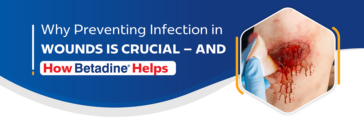 Why Preventing Infection in Wounds is Crucial — and How Betadine Helps