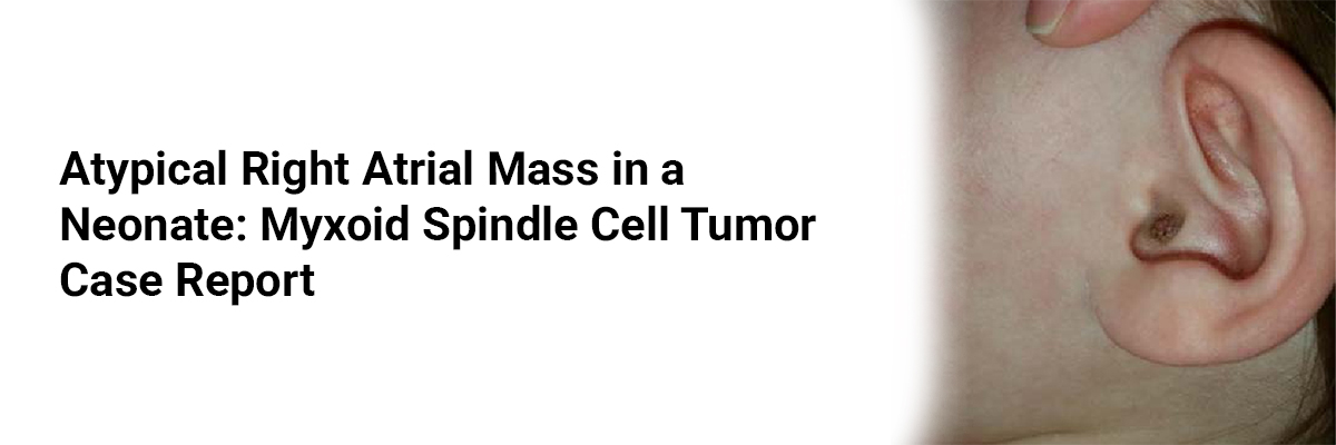 Atypical Right Atrial Mass in a Neonate: Myxoid Spindle Cell Tumor Case Report