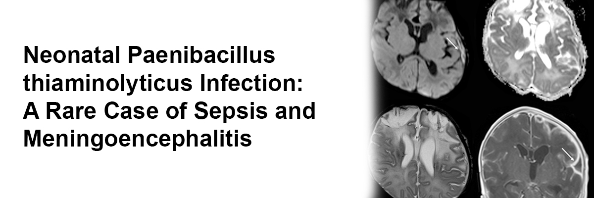 Neonatal Paenibacillusthiaminolyticus Infection: A Rare Case of Sepsis and Meningoencephalitis
