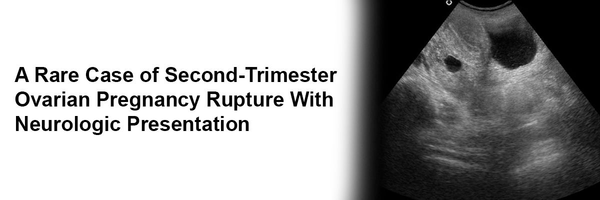 A Rare Case of Second-Trimester Ovarian Pregnancy Rupture With Neurologic Presentation
