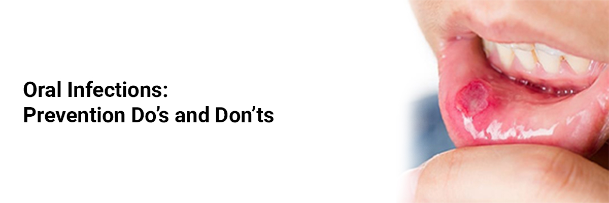 Oral Infections: Prevention Do's and Don'ts