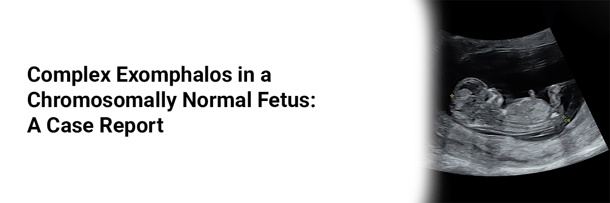 Complex Exomphalos in a Chromosomally Normal Fetus: A Case Report