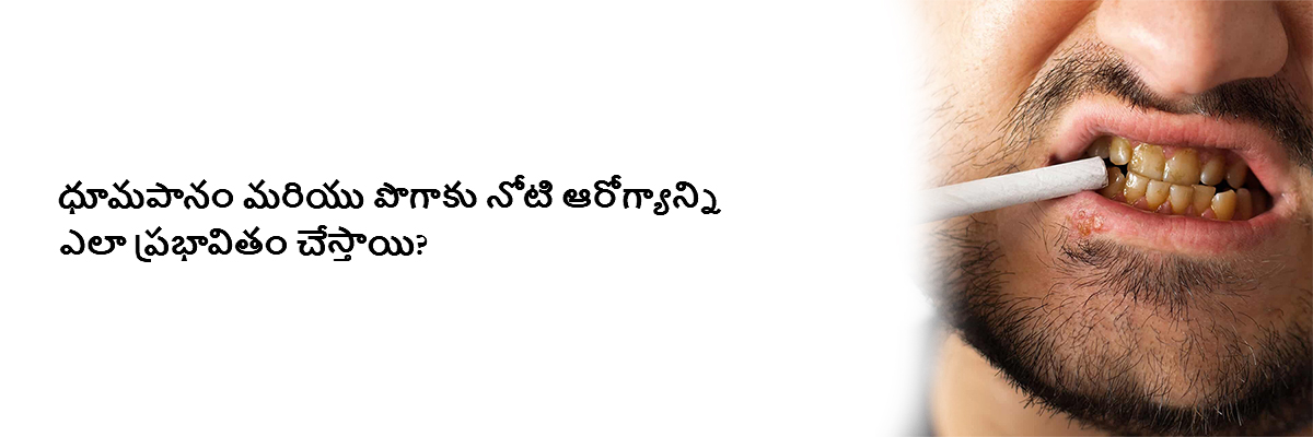 ధూమపానం మరియు పొగాకు నోటి ఆరోగ్యాన్ని ఎలా ప్రభావితం చేస్తాయి?
