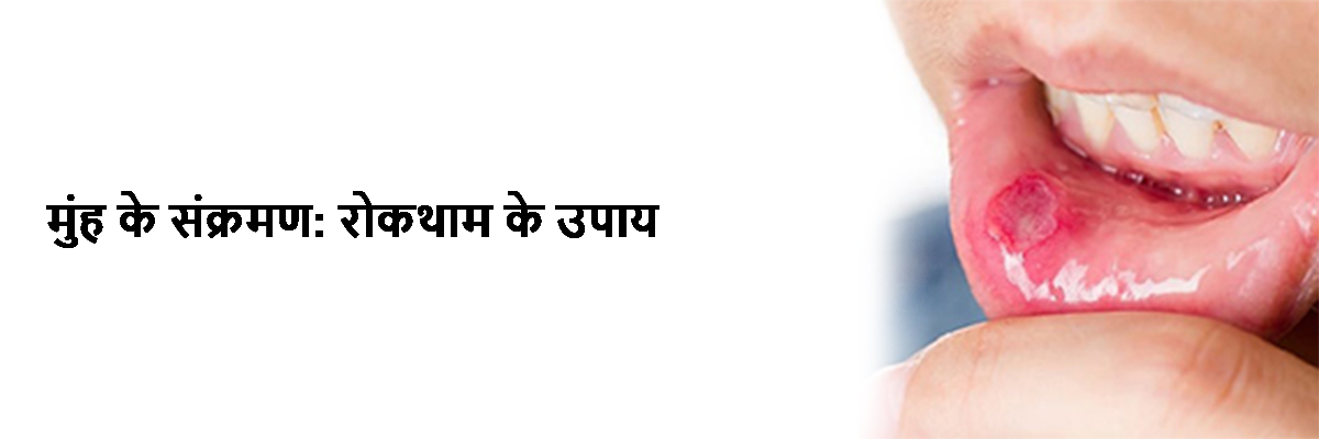 मुंह के संक्रमण: रोकथाम के उपाय