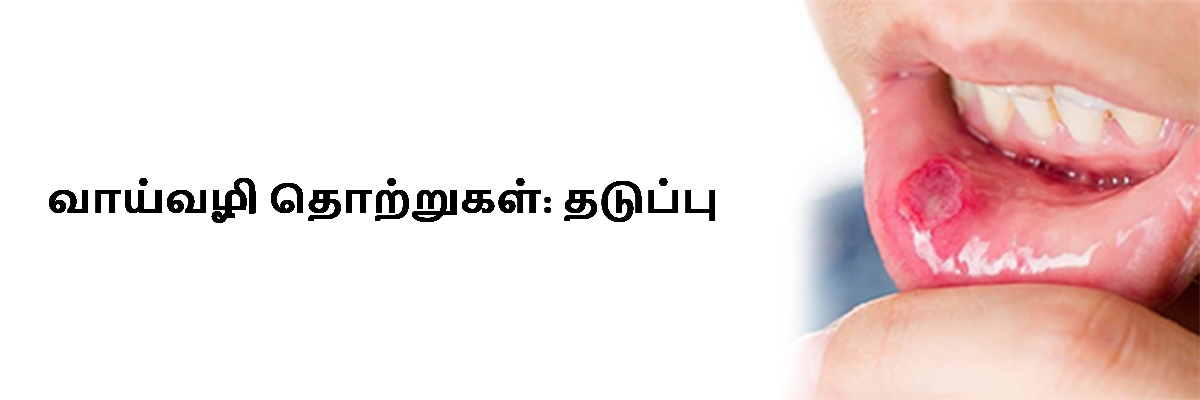 வாய்வழி தொற்றுகள்: தடுப்பு