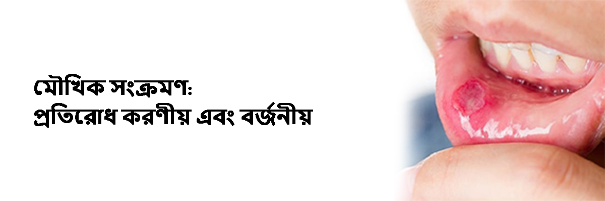মৌখিক সংক্রমণ: প্রতিরোধ করণীয় এবং বর্জনীয়