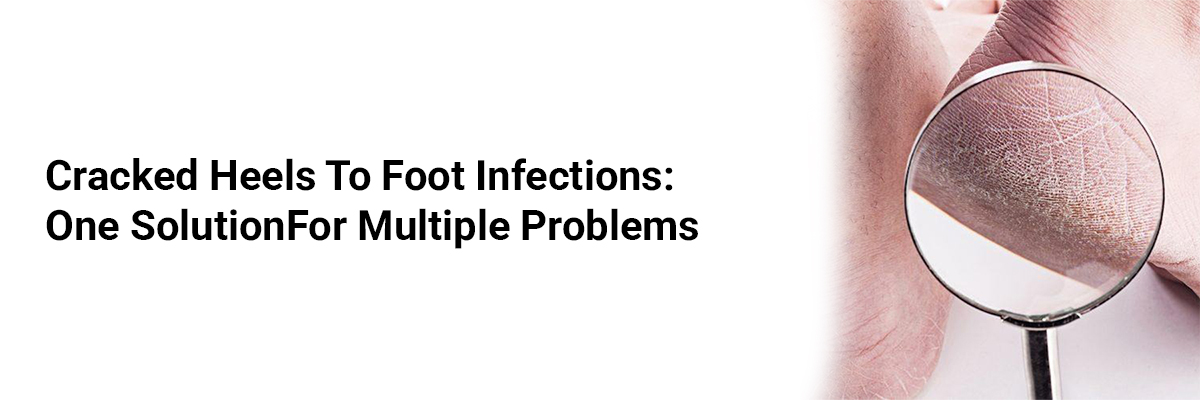 Cracked Heels To Foot Infections: One Solution For Multiple Problems