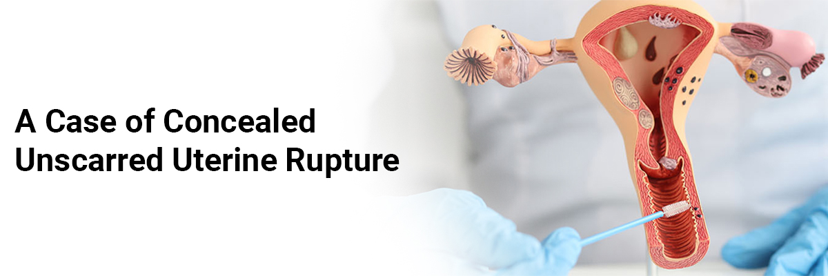 A Case of Concealed Unscarred Uterine Rupture