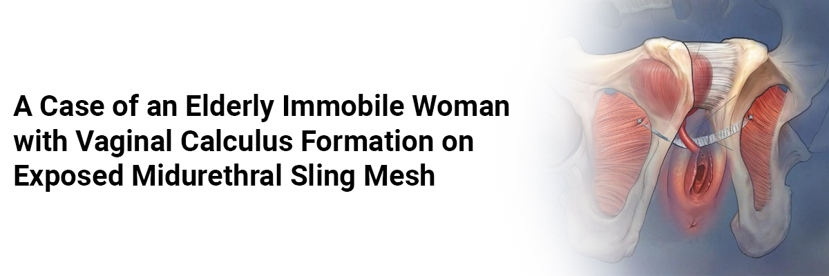 A Case of an Elderly Immobile Woman with Vaginal Calculus Formation on Exposed Midurethral Sling Mesh