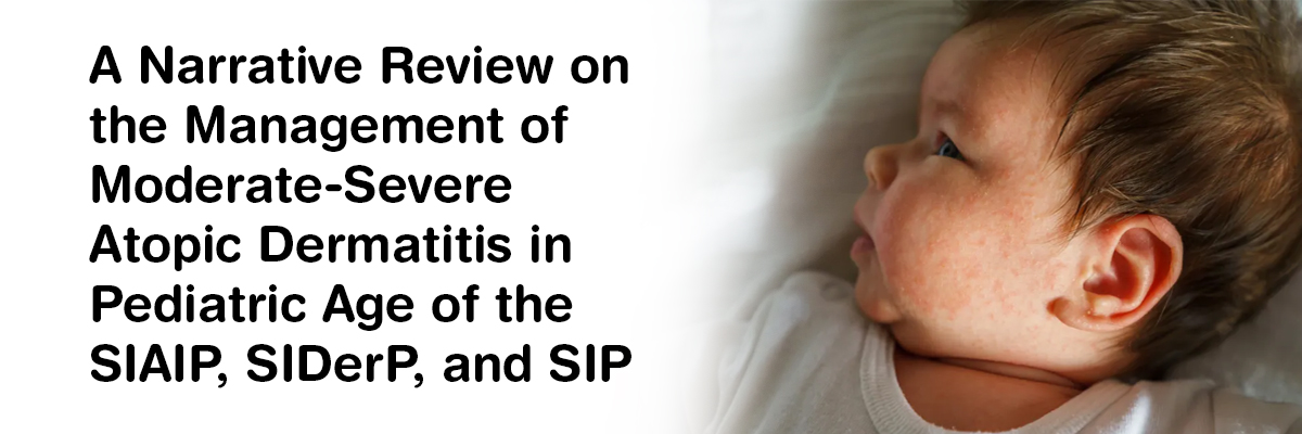 A narrative review on the management of moderate-severe atopic dermatitis in pediatric age of the SIAIP, SIDerP, and SIP