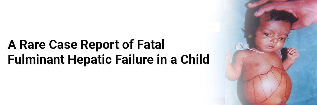 A Rare Case Report of Fatal Fulminant Hepatic Failure in a Child