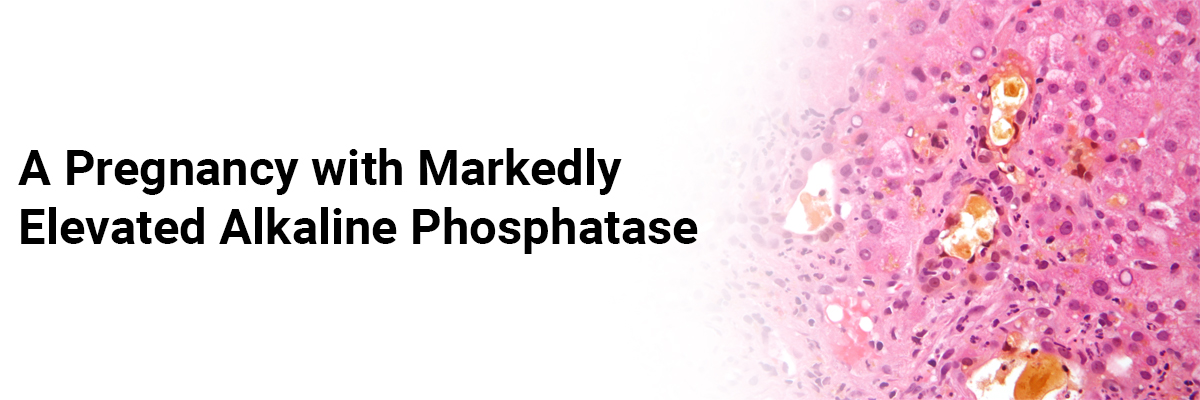 A pregnancy with markedly elevated alkaline phosphatase