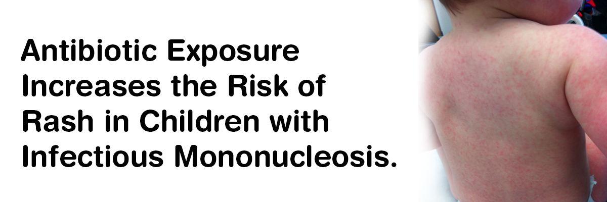 Antibiotic Exposure Increases the Risk of Rash in Children with Infectious Mononucleosis
