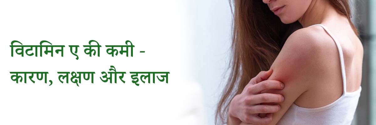 विटामिन ए की कमी  - कारण, लक्षण और इलाज | Vitamin A Deficiency – Causes, Symptoms and Treatment