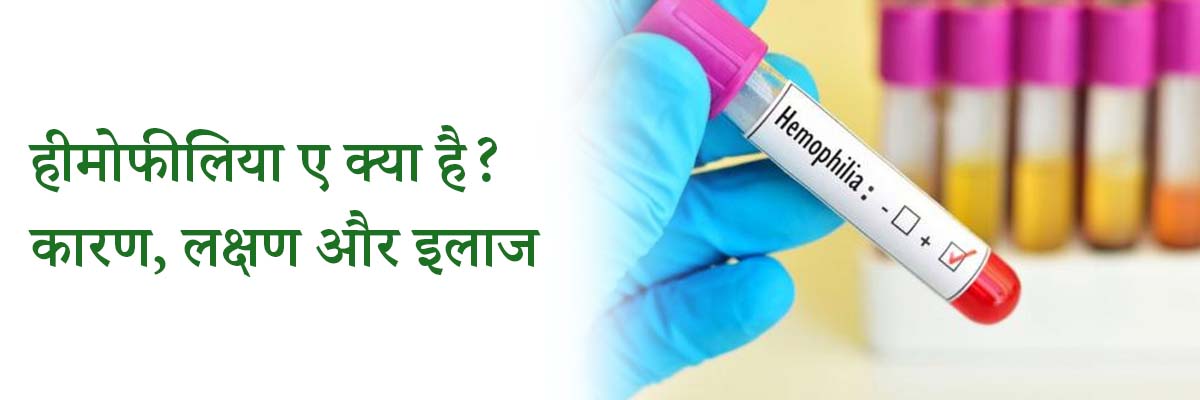 हीमोफीलिया ए क्या है? कारण, लक्षण और इलाज