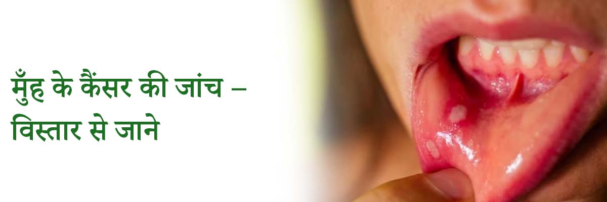 मुँह के कैंसर की जांच – विस्तार से जाने | Oral Cancer Screening – Know in Detail