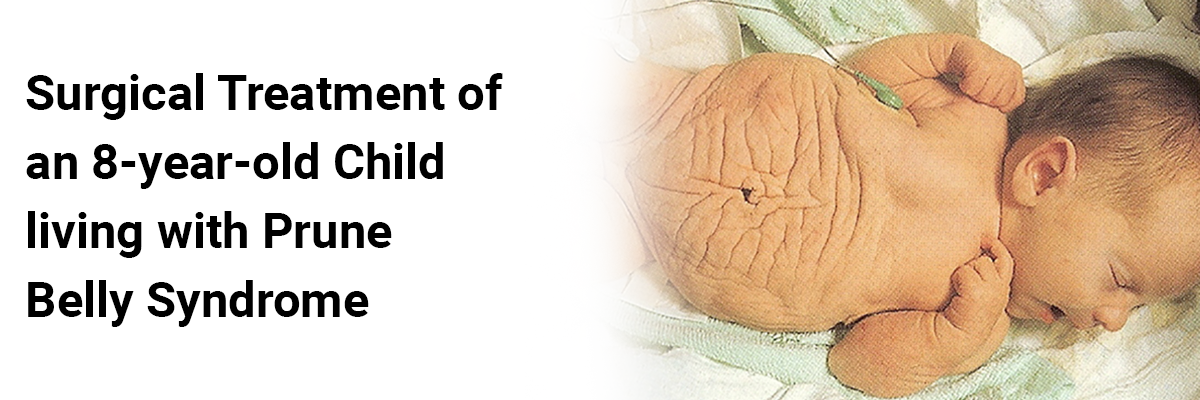 Surgical treatment of an 8-year-old child living with Prune Belly syndrome