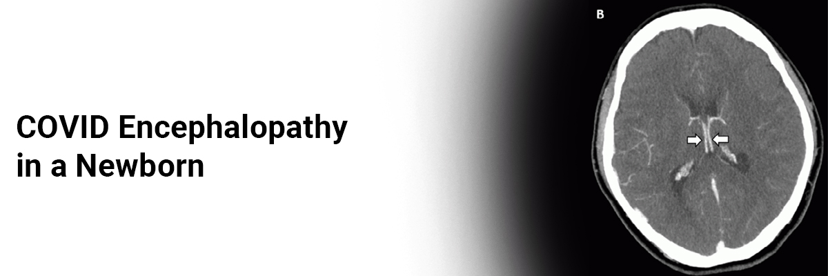 COVID Encephalopathy in a Newborn