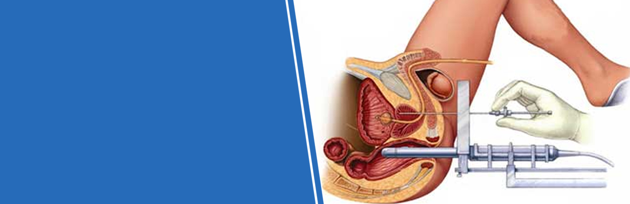 Can a biopsy cause a cancer to spread?