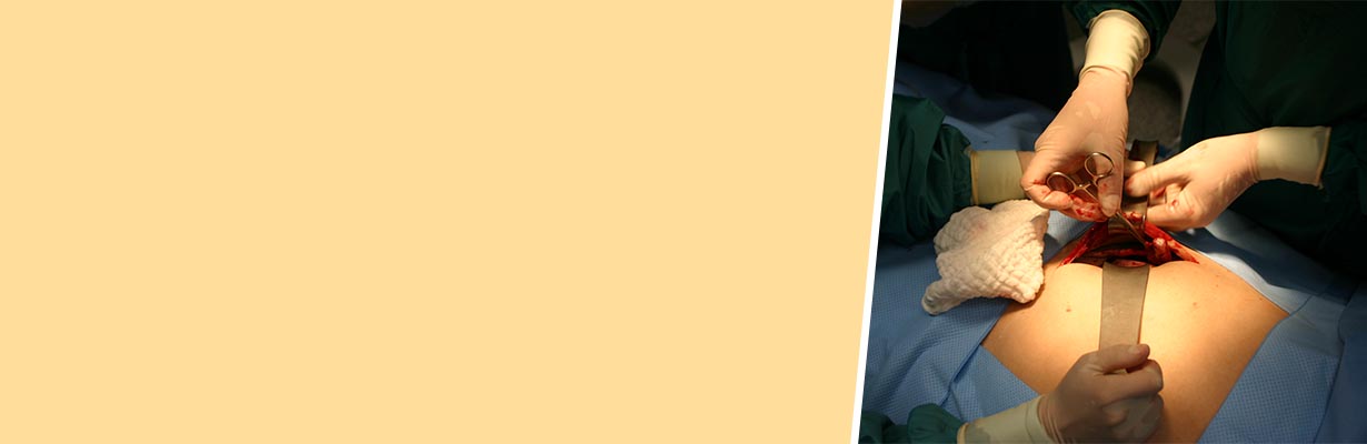 Can a person with acute appendicitis have normal appendix during surgery?