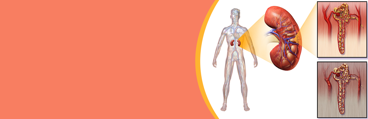 Can glycemic control minimize the risk of diabetic nephropathy?