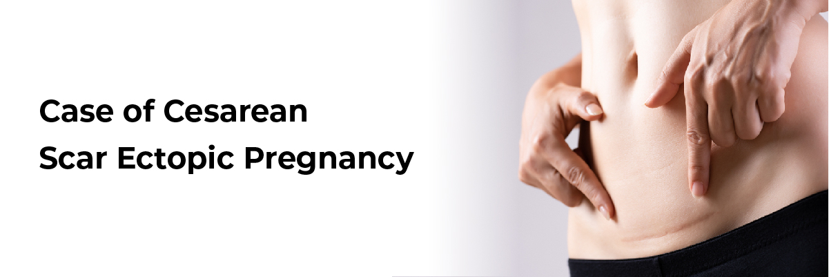 Case of cesarean scar ectopic pregnancy