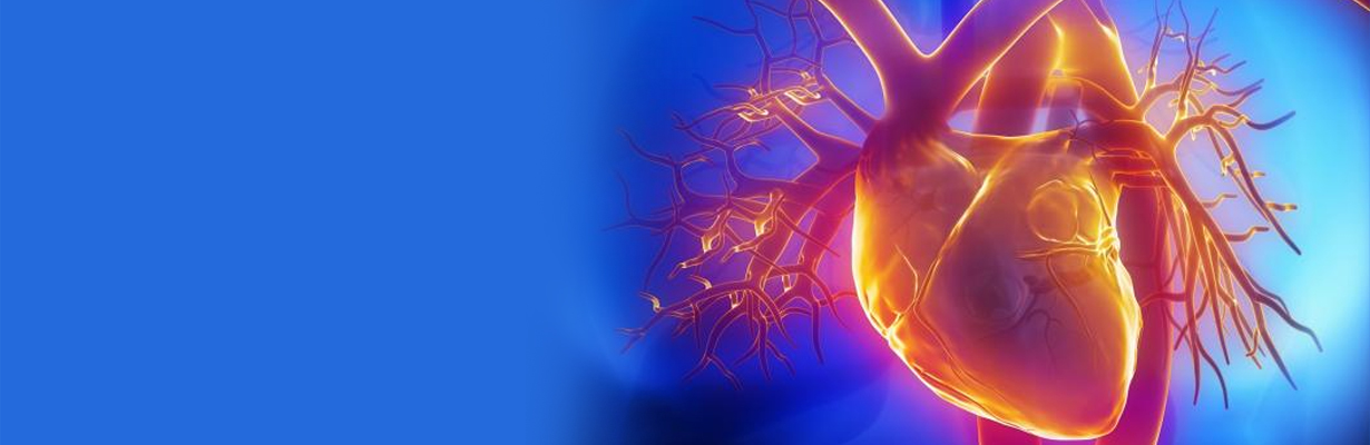 Characteristics of angina?