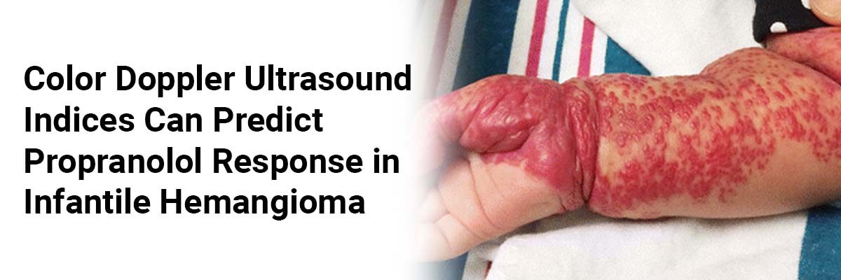 Color Doppler Ultrasound Indices Can Predict Propranolol Response in Infantile Hemangioma