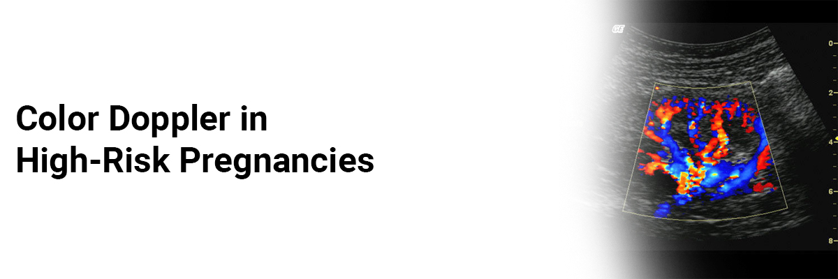 Color Doppler in high-risk pregnancies