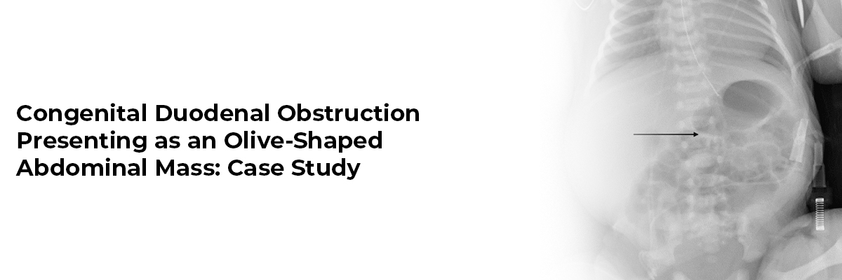 Congenital Duodenal Obstruction Presenting as an Olive-Shaped Abdominal Mass: Case Study