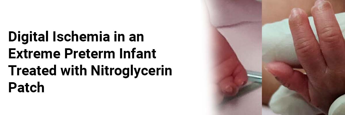 Digital Ischemia in an Extreme Preterm Infant Treated with Nitroglycerin Patch