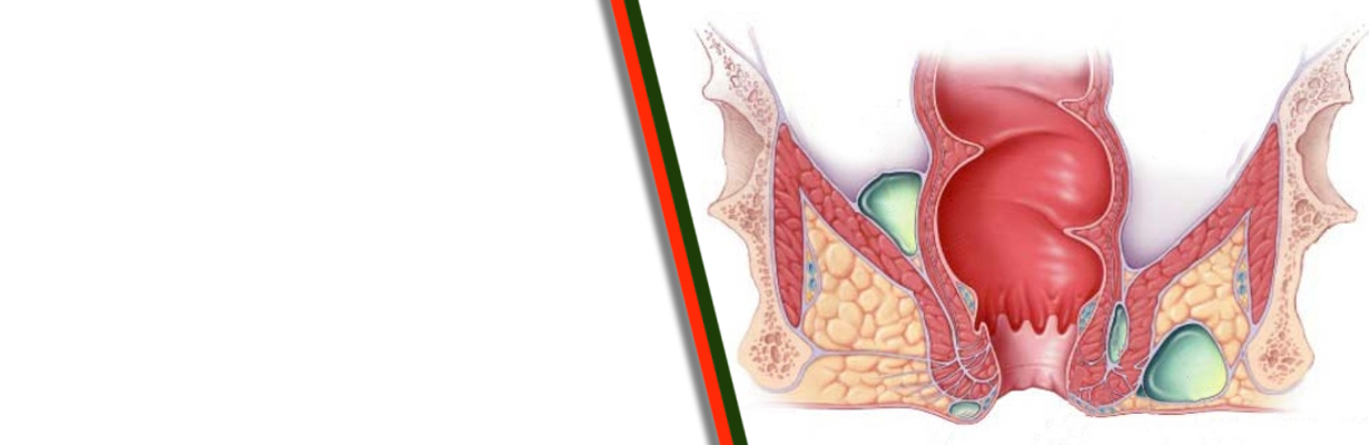 Discuss about anorectal conditions?