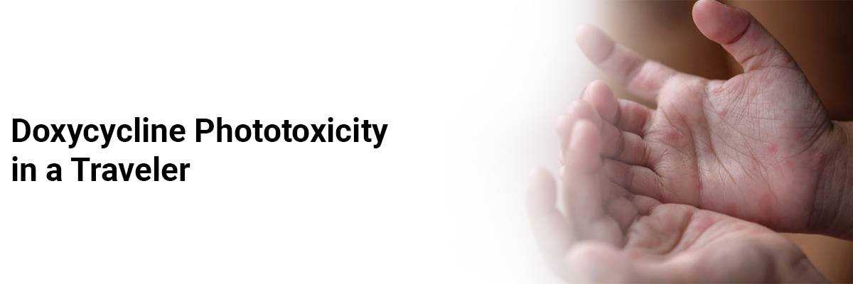 Doxycycline Phototoxicity in a Traveler