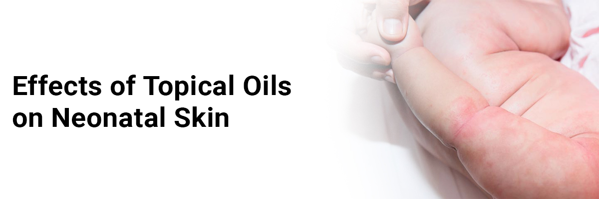 Effects of Topical Oils on Neonatal Skin