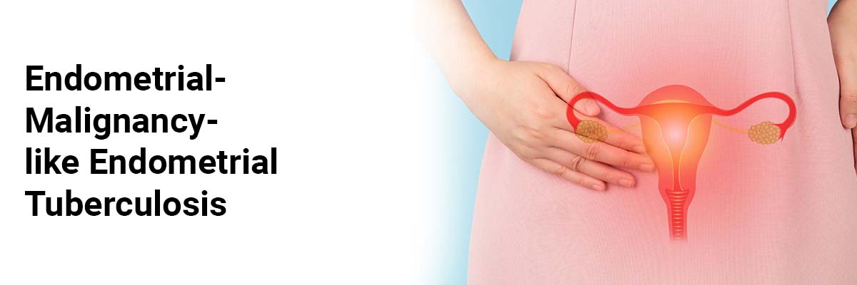 Endometrial-malignancy-like Endometrial tuberculosis