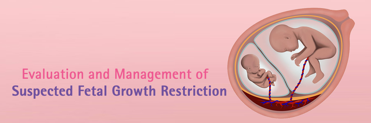 Evaluation and Management of Suspected Fetal Growth Restriction