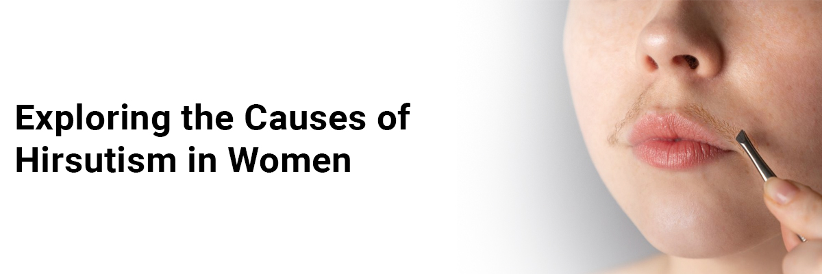 Exploring the causes of hirsutism in women