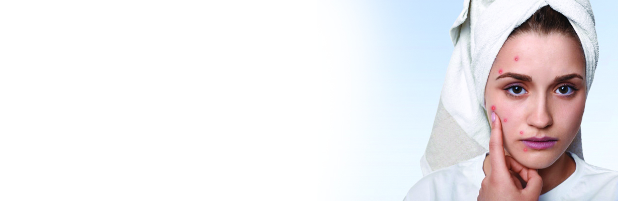 Know What causes Acne? Symptoms and Treatment 