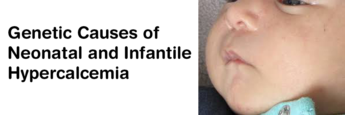 Genetic causes of neonatal and infantile hypercalcemia