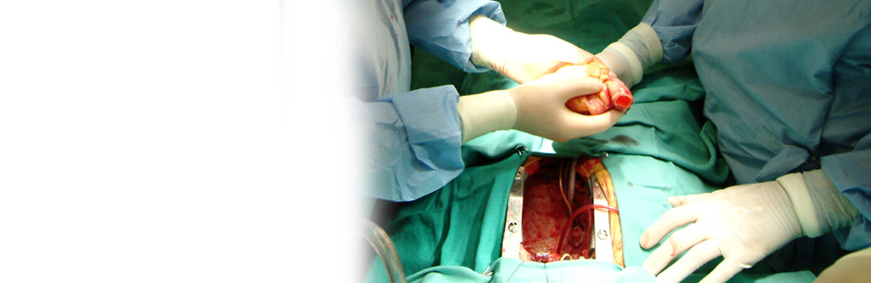 How difficult is cardiac transplant?