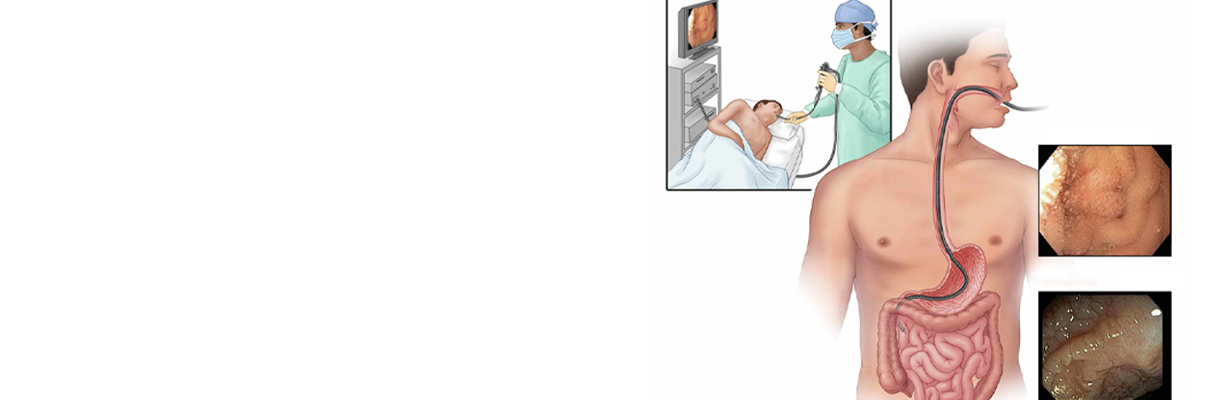 How to know if you have Celiac Disease?