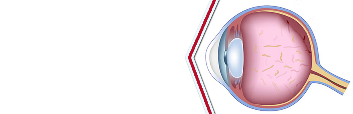 How is the retina examined?