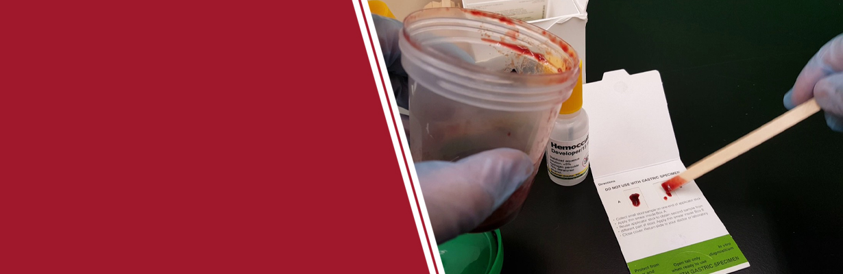 How reliable is stool occult blood?