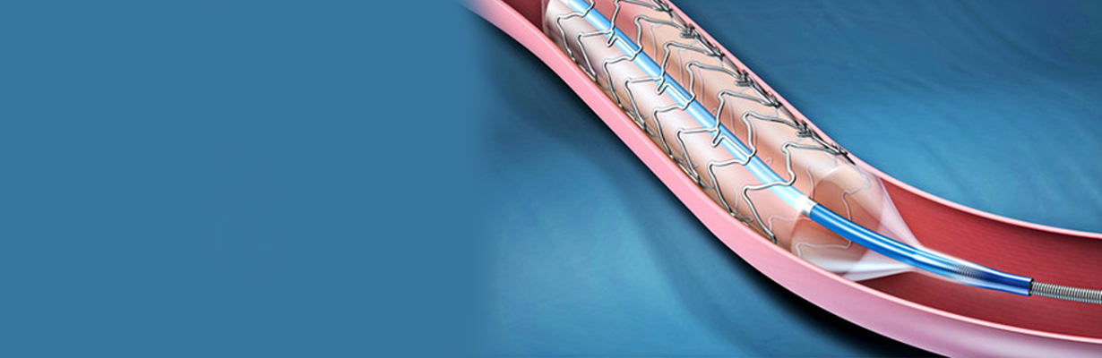 How safe is primary PCI?