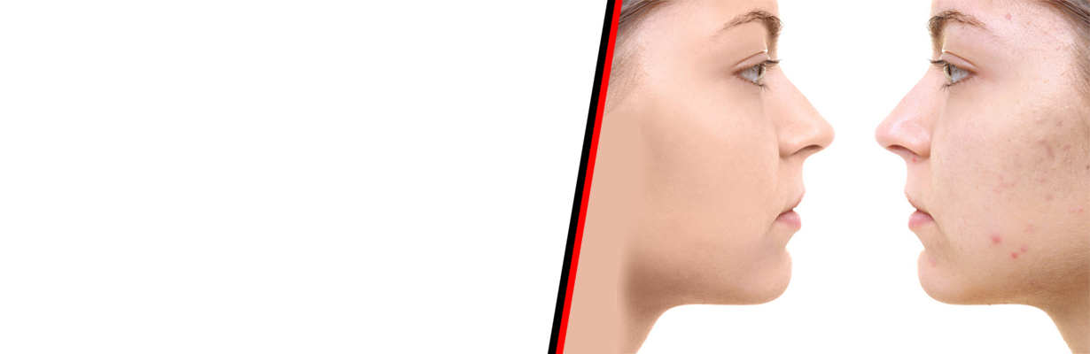 How to fade surgical scars ?