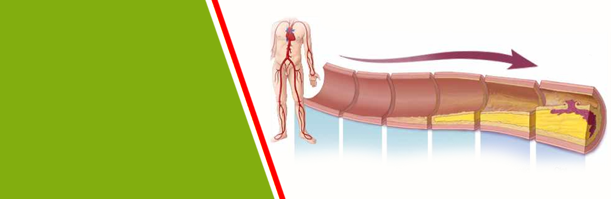 How should we check for penile vascular disease?