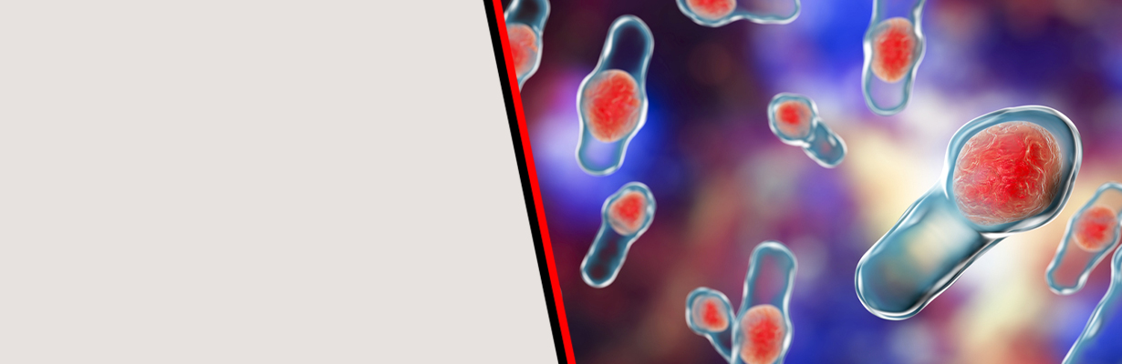 How should we classify and treat clostridium difficile infection?