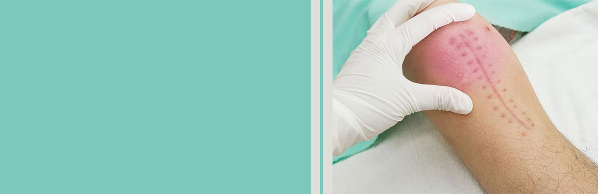 How common is infection after knee replacement?